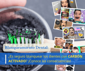 blanquear dientes carbon activado