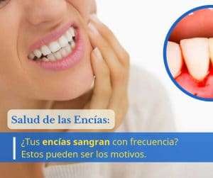 gingivitis periodontitis encias sangran